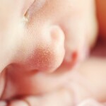 Mity na temat dziecięcego atopowego zapalenia skóry
